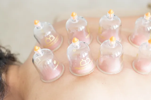 Abdominal Cupping