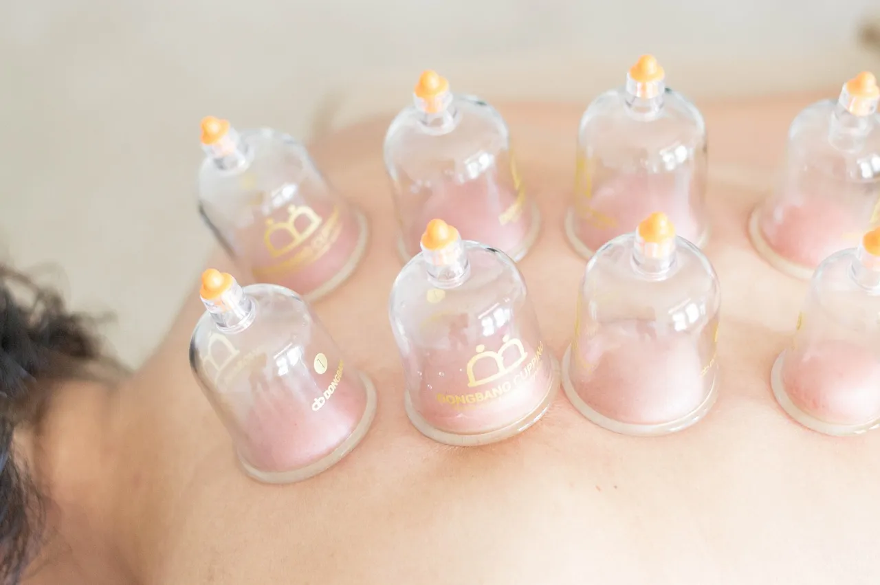 Abdominal Cupping